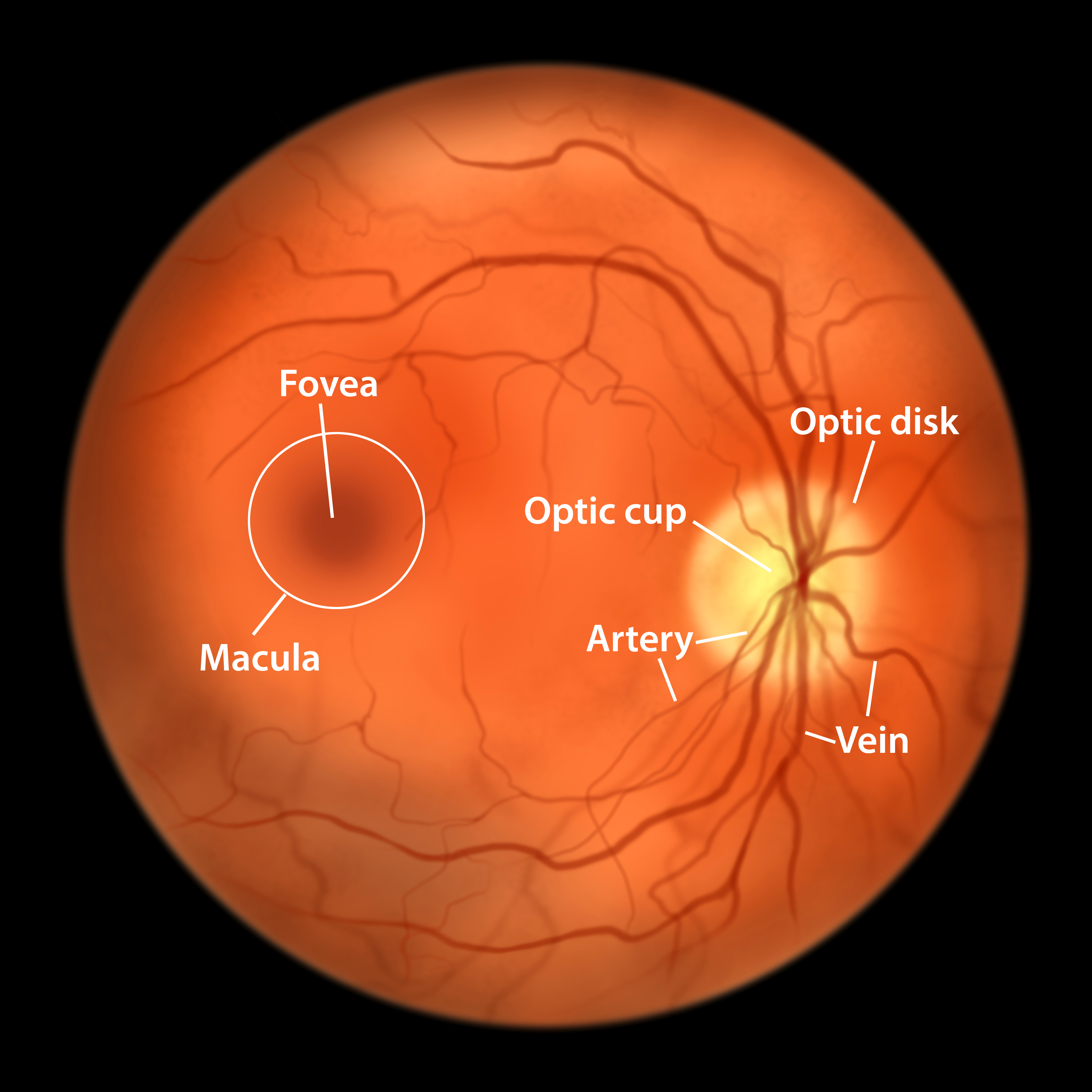 A retinal Photo